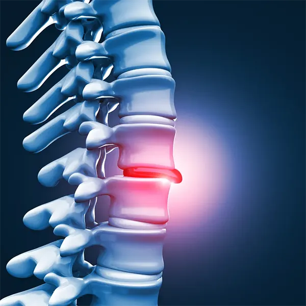 Disc injury treatment