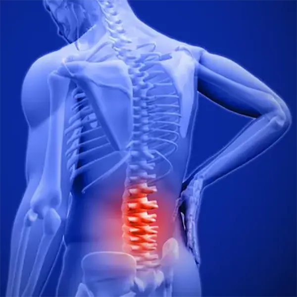 Spinal decompression therapy
